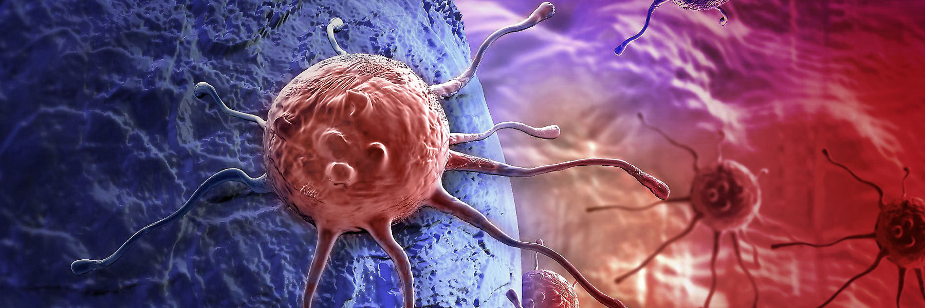 Acqua Alcalina Ionizzata: proprietà antitumorali